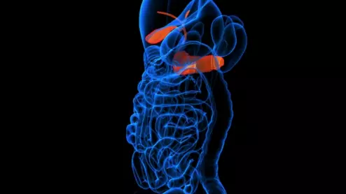 MRI-only screening of patietns at risk of pancreatic cancer shows promise