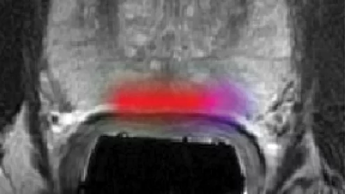 Hyperloop Mri Picture 2014 Fall | Radiology Business