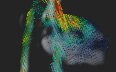 A 4D fetal heart MRI showing the major vessels and blood flow circulation being developed by the School of Biomedical Engineering and Imaging Sciences, Kings College London.  With further development, the method could become a new tool for aiding diagnosis of congenital heart disease where conventional methods like ultrasound might fail. Fetal hearts as so small and beat so face, it is very difficult to capture details. Fetal heart imaging.