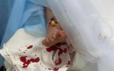 Boy from Kyiv area who was shot during the Russian advance on the city. Wounded on his side and neck and had a concussion. In the intensive care at Ohmatdyt pediatric hospital (https://ohmatdyt.com.ua/en/) intensive care unity in Kyiv Feb. 27, 2022. The military called an ambulance, and doctors performed an emergency surgery.