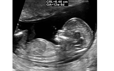 PHOTO GALLERY: What does fetal medical imaging look like?