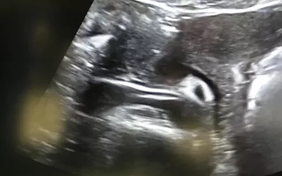 PHOTO GALLERY: What does fetal medical imaging look like?