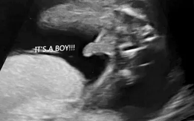 PHOTO GALLERY: What does fetal medical imaging look like?