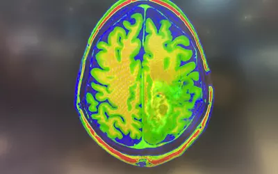 Brain MRI, from Sectra PACS, HIMSS 2023.