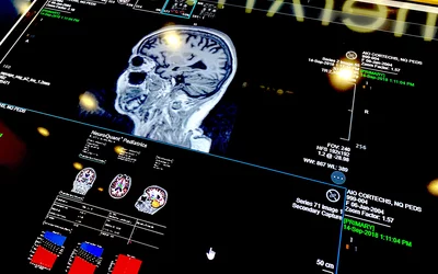 Merative enterprise imaging pediatric brain MRI at HIMSS23.