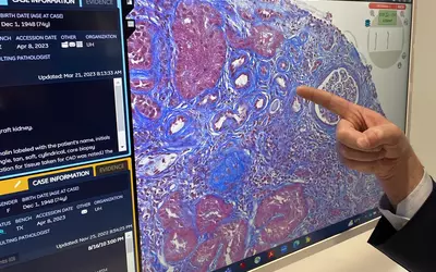 Example of digital pathology on an enterprise imaging system shown by Fujifilm at HIMSS 2023. Photo by Dave Fornell