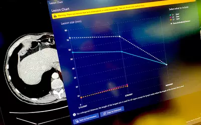 Tumor tracking feature of Sectra enterprise imaging system to more clearly show tumor regression or growth on serial exams. HIMSS23
