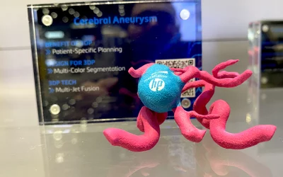 3D printed brain aneurism aneurysm shown by Materialise. RSNA23 DF #RSNA #RSNA23 #RSNA2024