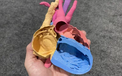  3D printed congenital single ventricle patient from a CT scan, displayed at RSNA 2023 by Medviso. Models like this can help in surgical preplanning and peri-procedural guidance.#RSNA #RSNA23 #RSNA2024 #SCAI