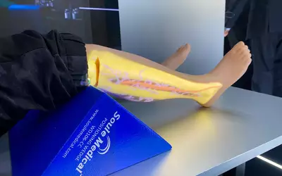 AI automated registration on medical imaging projected onto the patient's skin so surgical planning and marking the patient. Shown as a work in progress by United Imaging at RSNA 2023. Photo by Dave Fornell. #RSNA #RSNA23 #RSNA2023 orthopedic imaging