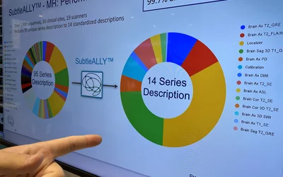 AI intelligent workflow orchestration SubtleALLY naming genie consolidates 95 MRI series descriptions into just 14. Photo by Dave Fornell. #RSNA #RSNA23 #RSNA2023