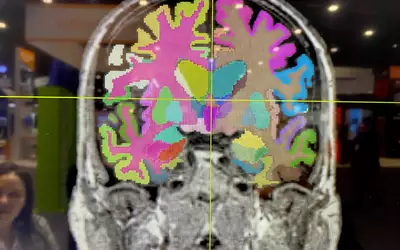 【美品・電子版使用済】Diagnostic Imaging: Brain 脳画像 PHOTO GALLERY of brain imaging