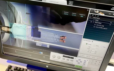 Automated AI isocentering of patient with overhead camera on United Imaging uCT Atlas scanner. Photo by Dave Fornell. #RSNA #RSNA23 #RSNA2023 orthopedic imaging