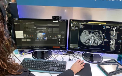 Philips launched the CT collaborative remote access technology for technologists and radiologists to remote into CT system control rooms to help troubleshoot, even if they are not at the same imaging center. Photo by Dave Fornell. #RSNA #RSNA23 #RSNA2023