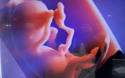 Fetal imaging 4 weeks old 3D on GE Voluson Expert 22 ultrasound at RSNA23.