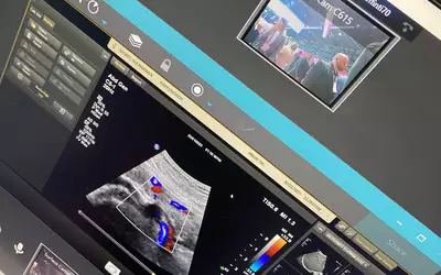 Example of remote access technology where a more experience sonographer from another location can remote in to see the settings and imaging on the system to help trouble shoot, or a physician can do remote consultations. Photo by Dave Fornell #RSNA #RSNA23 #RSNA2023