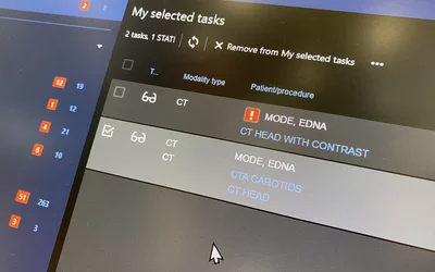 Stat reading list view on the Agfa AI orchestrated workflow radiology work list. Photo by Dave Fornell #RSNA $RSNA2023 #RSNA23
