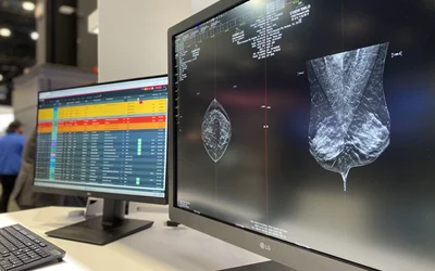 Exa Enterprise workflow orchestration list mammopgraphy Konica Minolta RSNA 2024 DF