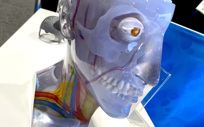 Medicine healthcare 3D printed head stratasys RSNA 2024. Photo by Dave Fornell