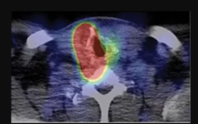 PHOTO GALLERY: What do thyroid nodules look like on imaging
