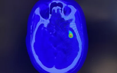 PHOTO GALLERY: Radiology technologies at RSNA 2025