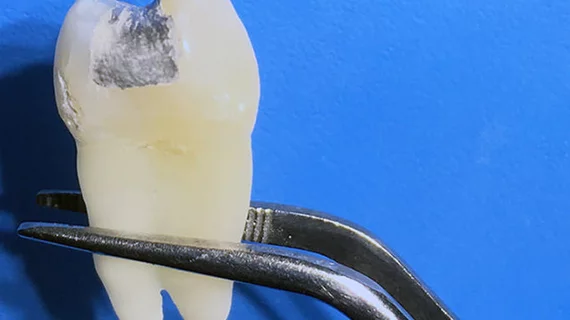 Cavity Cavity