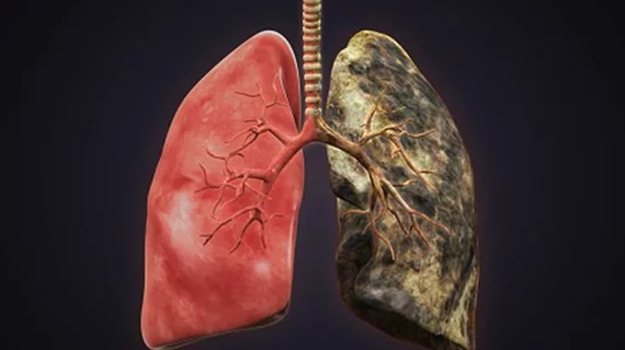 bad-lungs_759_getty.jpg bad-lungs_759_getty.jpg