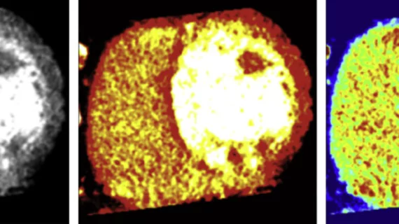 Does display color scale affect diagnostic imaging performance?