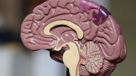 Brain Brain