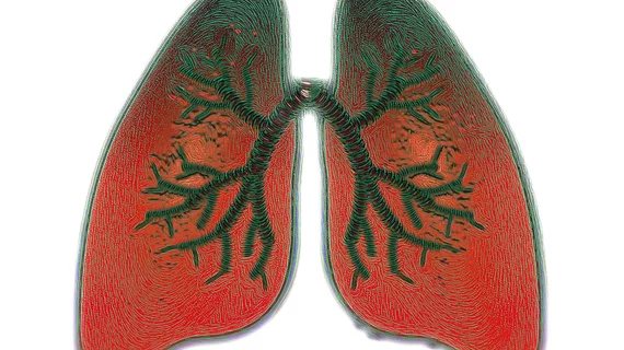 Lungs Lungs