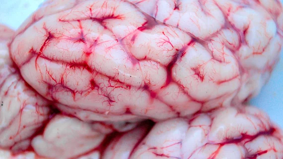 Brain