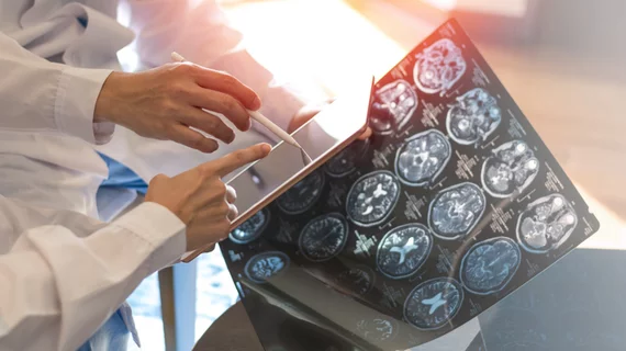Brain scan Brain scan