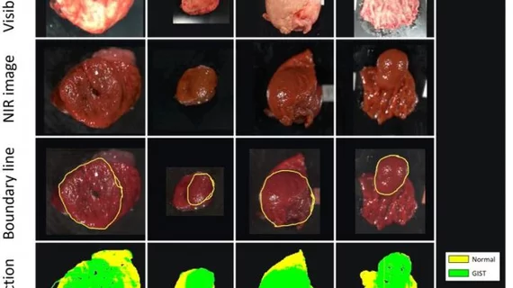 Hyperspectral imaging Hyperspectral imaging