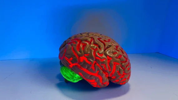 brain.jpg brain.jpg