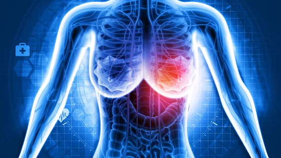 breast cancer mammography mammogram breast cancer mammography mammogram