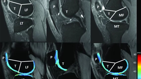 knee_mri.png knee_mri.png