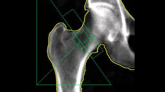 An example of dual-energy X-ray absorptiometry (DXA) imaging. Image courtesy of RSNA