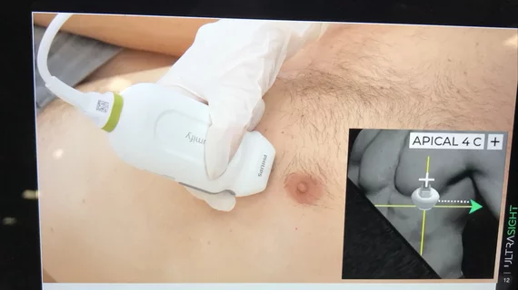 AI-guided diagnostic quality echocardiograms Novice medical professionals perform diagnostic quality echocardiograms with AI guidance