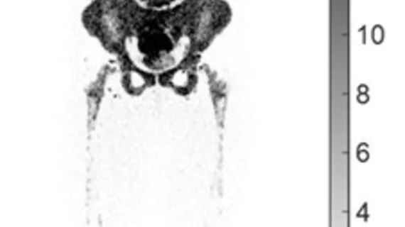 petctcovid.jpg