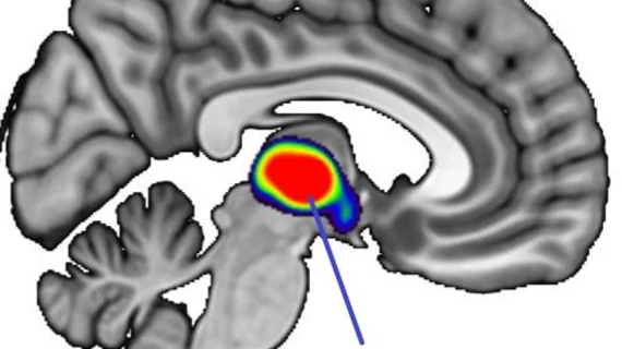 thalamus thalamus