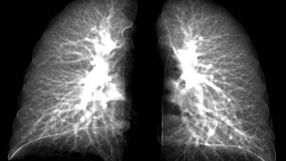 post-covid-lung-story-photo.jpg post-covid-lung-story-photo.jpg