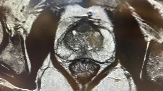Prostate MRI on Sectra PACS, HIMSS23.