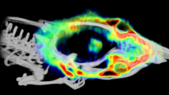 Folate-based radiopharmaceuticals could improve detection of gliomas
