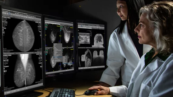 Breast imaging mammography GE Centricity Universal Viewer with Native Breast Imaging. GE RSNA PR image