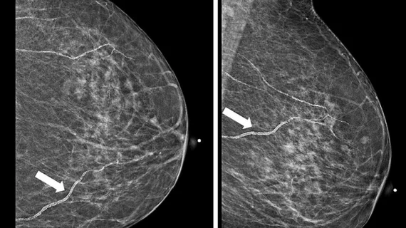 Breast Imaging | Radiology Business