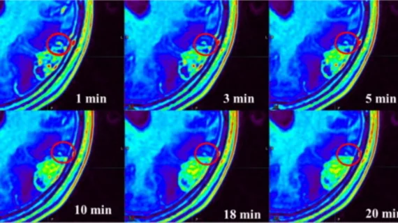time-delayed MRI phases improve brain tumor visualization