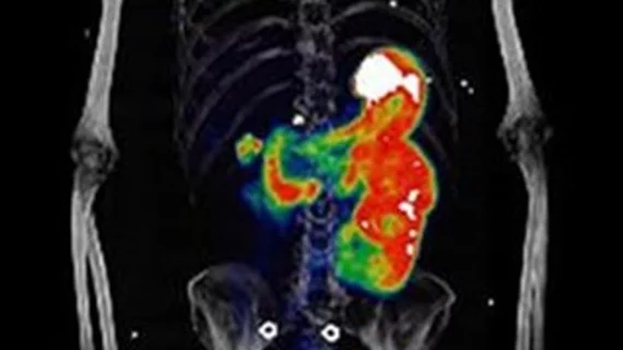 Whole-body maximum-intensity projections over time after [68Ga]Ga-DPI-4452 administration. 