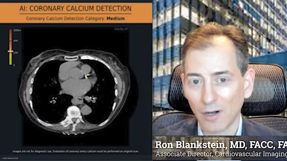 Ron Blankstein, MD, Brigham and Womens Hospital, explains a study using AI opportunistic screening in non-cardiac CT scans looking for coronary artery disease.