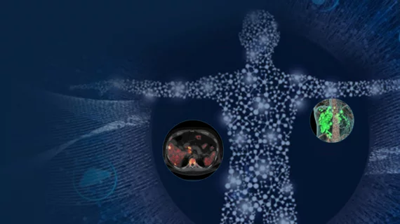Theranostics GE HealthCAre