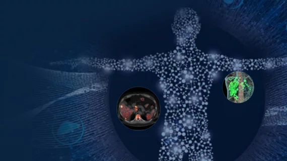 Theranostics GE HealthCAre
